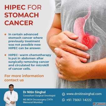 Stomach Cancer Surgeon in Ahmedabad Accurate Surgery