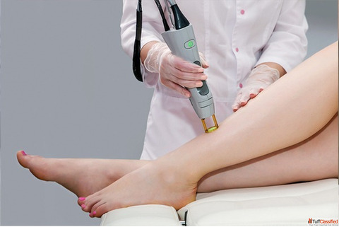 Laser Hair Removal - Smooth Skin Zero Hassle