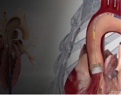 Best TAVI Doctor in Mumbai