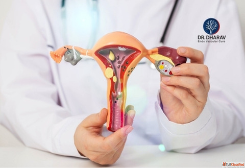 Effective Uterine Fibroids Treatment by Dr. Dharav Kheradia in Mumbai India