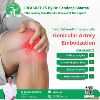 Descending Genicular Artery Treatment by Dr. Sandeep Sharma