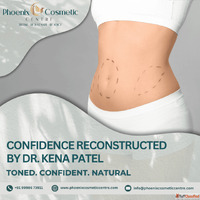 Phoenix Cosmetic Offers Professional Tummy Tuck Surgery in A...