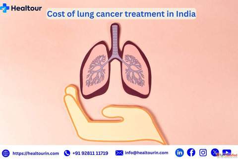 Lung Cancer Treatment Cost in India Affordable Trusted