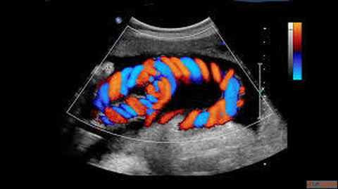 Best Color Doppler in South Delhi