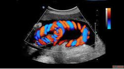 Best Color Doppler in South Delhi