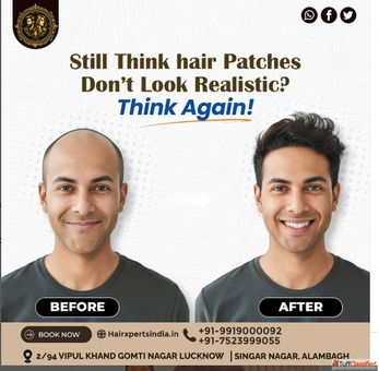 Outstanding Hair Patch Salon In Lucknow