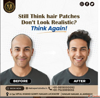 Outstanding Hair Patch Salon In Lucknow