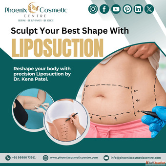 Effective Liposuction Surgery in Ahmedabad at Phoenix Cosmetic Centre
