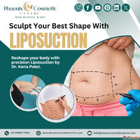 Effective Liposuction Surgery in Ahmedabad at Phoenix Cosmet...