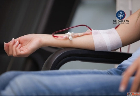 Advanced AV Fistula Procedures by Dr. Dharav Kheradia in Mumbai India