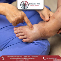 Expert Diabetic Foot Treatment in India by Dr. Krunal Gohil
