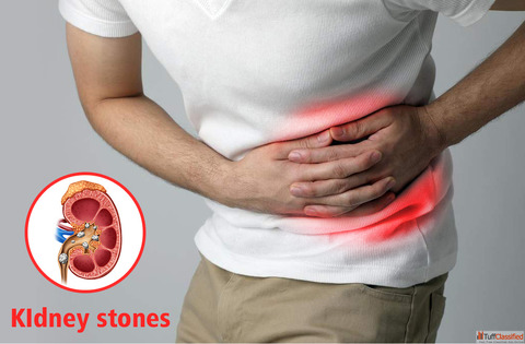 Top Homeopathy Doctor in Noida for Safe Kidney Stone Treatment