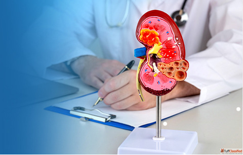Treat Your Kidney Stones With Trusted Homeopathic Care
