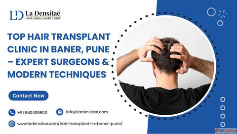 Top Hair Transplant Clinic in Baner Pune - Expert Surgeons Modern Techniques