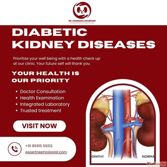 Treatment for Diabetic Kidney Disease in Mumbai - Dr. Chandan Chaudhari