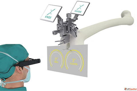 Looking for a reliable knee replacement in Ahmedabad