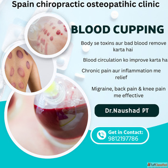 Blood Cupping Therapy for Pain Relief Ghaziabad
