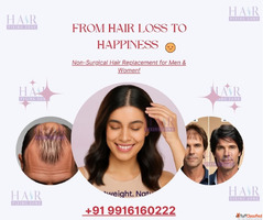 The Smart Way to Deal with Hair Loss