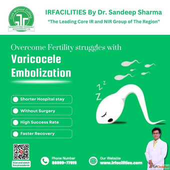 Best Varicocele Treatment IRFacilities