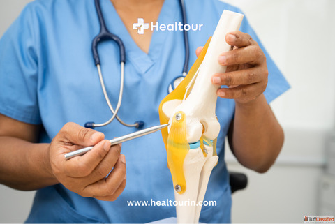 Cost of Knee Replacement Surgery in India