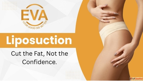 From Non-Surgical Slimming to VASER Liposuction in Delhi A Modern Body-Sculpting Guide
