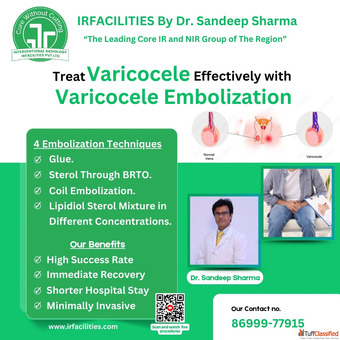 Varicocele Embolization Cost in India - A Complete Overview