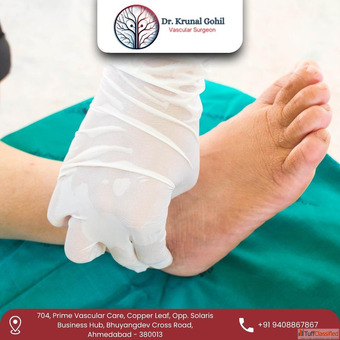 Trusted Doctor for Gangrene Treatment in India - Dr. Krunal Gohil