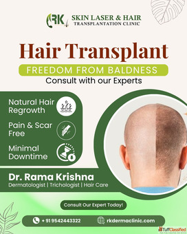 Balding Not Anymore Meet the Best Hair Transplant Surgeon Near You