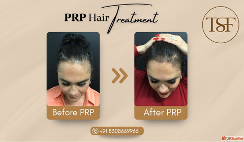 Trusted Skin Specialist in Kondhwa - Book Your Appointment