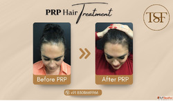 Trusted Skin Specialist in Kondhwa - Book Your Appointment