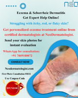 Online Eczema Treatment - Consult Top Skin Specialists NeoDe...
