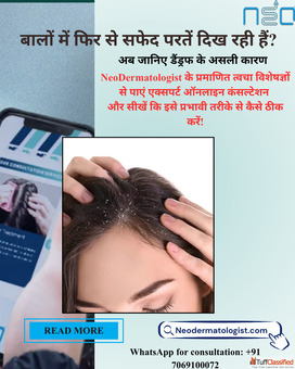 Online Dandruff Treatment