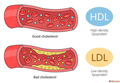 Keep Your Heart Strong with Homeopathic Medicine for Cholesterol