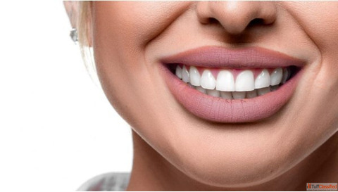 Professional Teeth Whitening in Andover Dental Concepts