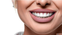 Professional Teeth Whitening in Andover Dental Concepts