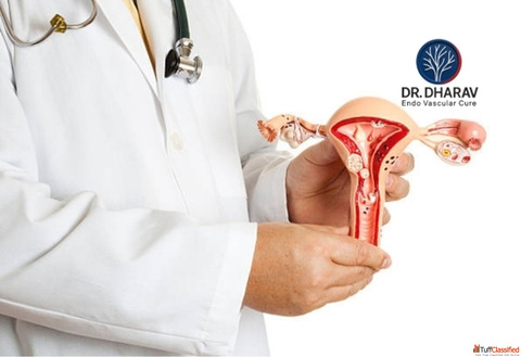 Uterine Fibroid Specialist in Mumbai India - Dr. Dharav Kheradia