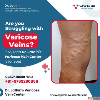 Precision Vascular Care Tailored to Your Needs