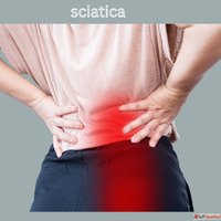 Sciatica Treatment in Ghaziabad - Chiropractic Physiotherapy...