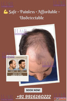 Non-Surgical Hair Fixing for Male Pattern Baldness 100 Natur...
