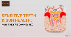 Sensitive Teeth Gum Health How to Stop the Pain at Its Sourc...