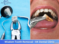 Modern Reliable Dental Clinic in Vile Parle East AK Dental C...