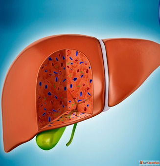 Dr. Chetan Kalal - Best Treatment for Fatty Liver in Mumbai