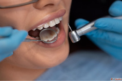 Dental Implants Treatment in Kukatpally Banjara Hills