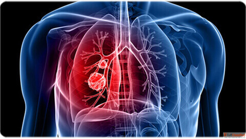 Top 10 Lung Specialists in Nashik Best Pulmonologists Near You - Docindia.org