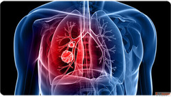 Top 10 Lung Specialists in Nashik Best Pulmonologists Near Y...