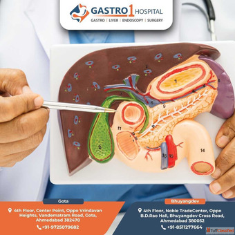 Best Gallbladder Stone Specialists in Ahmedabad - Gastro1 Hospital