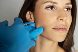 Botox for TMJ in Kingston Ontario