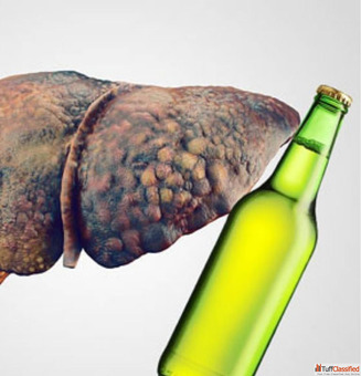 Consult Dr. Chetan Kalal for Alcoholic Liver Disease Treatment in Mumbai