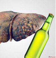 Consult Dr. Chetan Kalal for Alcoholic Liver Disease Treatme...