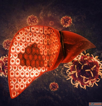 Dr. Chetan Kalal - Liver Cancer Treatment in Mumbai